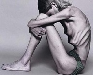 The reality of supermodels -- glamorizing starvation
(Checkout the Campaign For Real Beauty online)